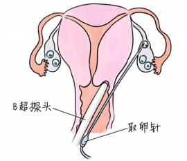 幼儿学画画，合肥捐卵宝宝学画画，学画画的好处，如何学画画