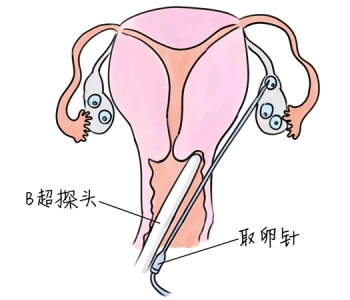 幼儿学画画，合肥捐卵宝宝学画画，学画画的好处，如何学画画